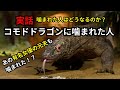 実話!コモドドラゴンに噛まれた人の衝撃事例!
