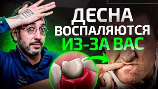 Воспаление десен – ошибки пациентов. НИКОГДА так НЕ делайте!