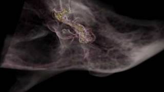 Anatomical Volume Visualization with Weighted Distance Fields