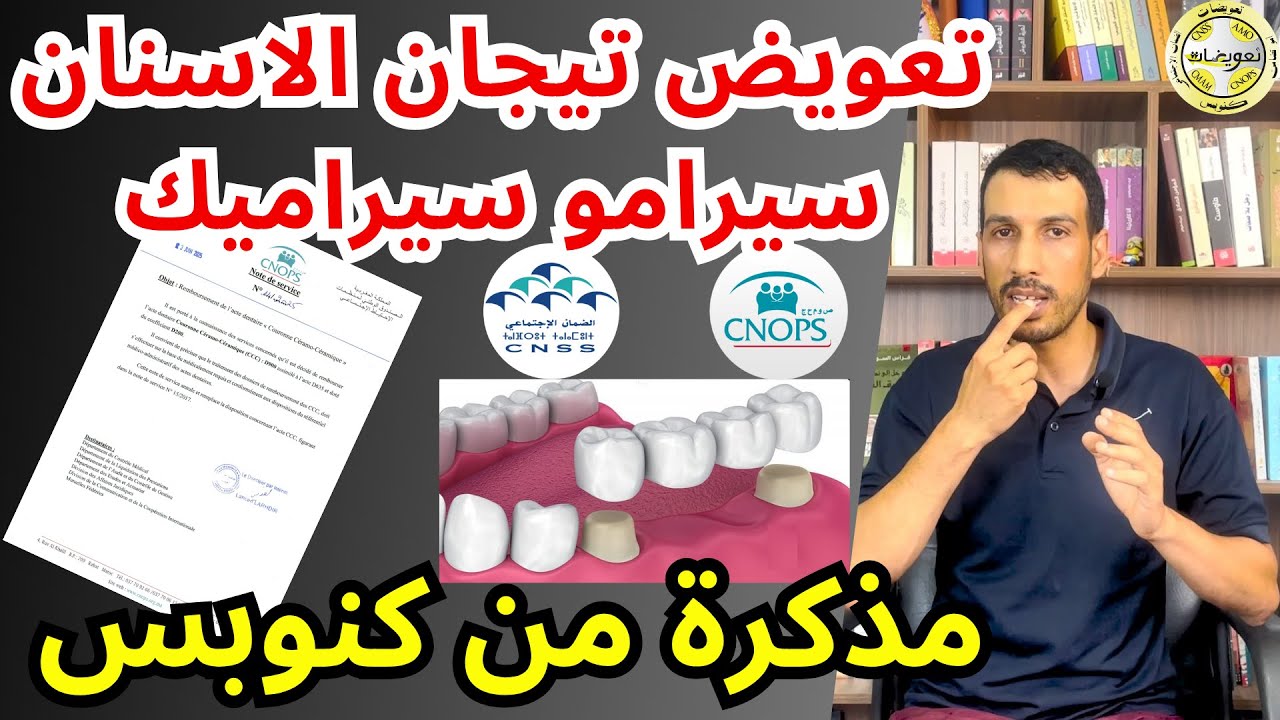 مذكرة تعويض تيجان الاسنان نوع سيرامو سيراميك كيفاش العمل المؤسساتي كيجيب ليك حقك CNOPS CCC