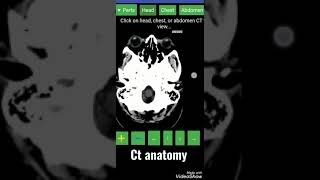 Ct anatomy/ best application for the phone screenshot 2