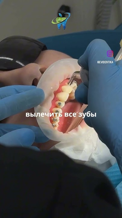 Эвидент | Стоматология Белгород | Брекеты за 10 000 рублей - YouTube