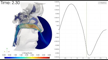 Fluid dynamic analysis of a human nose - CFD OpenFOAM