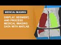 Display, Segmentation, and Processing of Medical Images with MATLAB