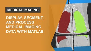 Display, Segmentation, and Processing of Medical Images with MATLAB screenshot 4