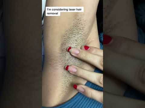 Permanent hair removal solution. #beauty #skincare #shorts