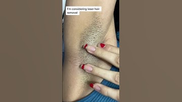 Permanent hair removal solution. #beauty #skincare #shorts