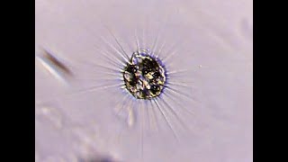 Vampyrella: The Vampire amoeba