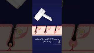 هل جهاز إزالة الشعر المنزلي متعدد الوظائف مفيد؟laserhairremoval foryou ipl kinseibeauty e3