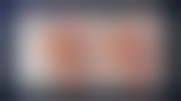 Treatment of Giant Dolichoectatic Basilar Trunk Aneurysm with M2-RAG-P2 Bypass and EV Occlusion