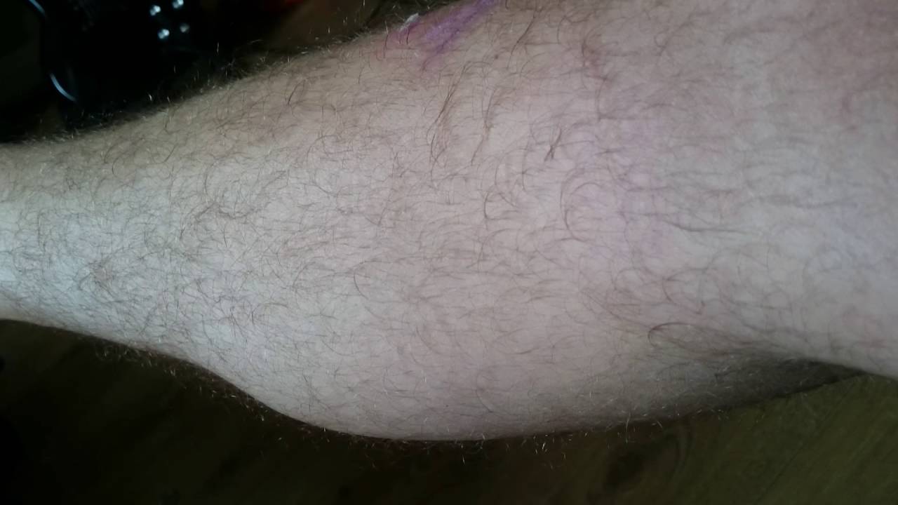 Crazy muscle spasms after 70 mile long distance cycling. YouTube