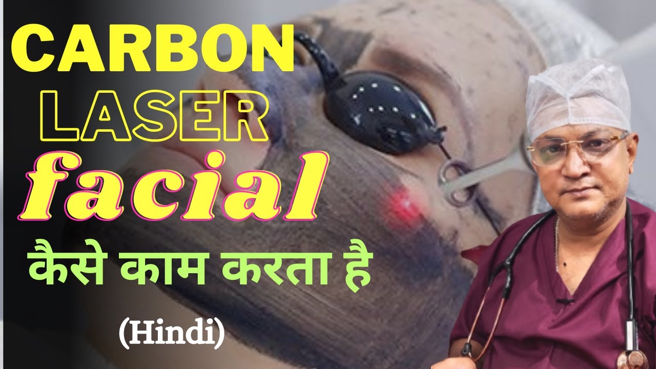 Carbon Laser Facial Treatment for Glowing Skin in Hindi कार्बन लेजर