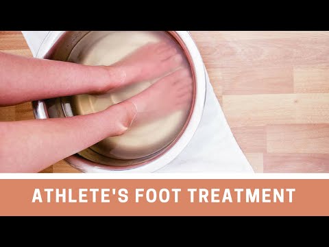 How to Make Athlete&rsquo;s Foot Treatment & Spray