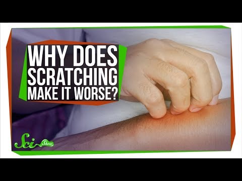 Video: Ce este pielea zgâriată?