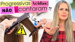 🚨 PROGRESSIVAS ÁCIDAS: Tudo que você precisa saber! { CONTA MAIS }