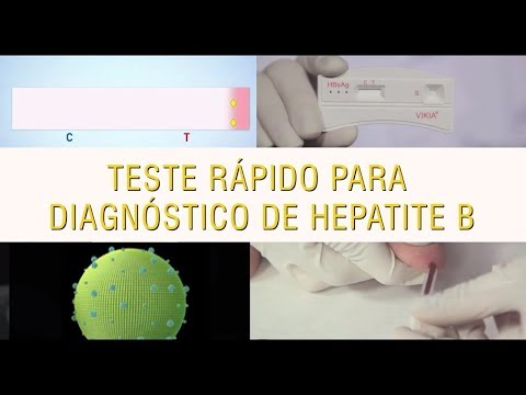 Vídeo: Conformidade Entre Crianças Expostas Ao Vírus Da Hepatite B Em Um Programa De Testes Sorológicos Pós-vacinação Em Quatro Províncias Da China