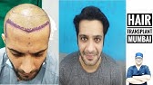 Hair Transplant in Qatar - YouTube