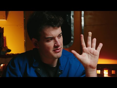 The Day I Lost 2 Fingers