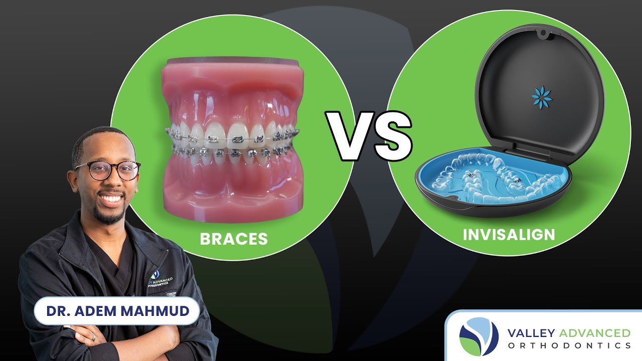 Braces vs Invisalign: Which Is Better for Teens & Adults in 2026? | Orthodontist Explains