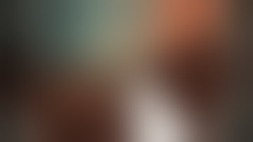 Colonoscopy: Ascending Colon - Subtle SSA - EMR and Clip Closure