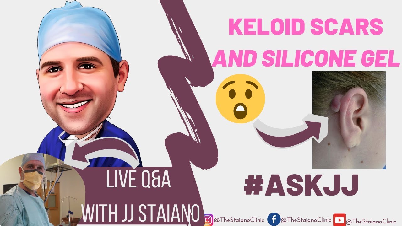 Keloid Scars and Silicone Gel YouTube