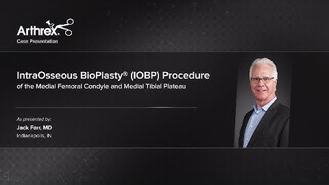IntraOsseous BioPlasty® (IOBP) Procedure of the Medial Femoral Condyle and Medial Tibial Plateau