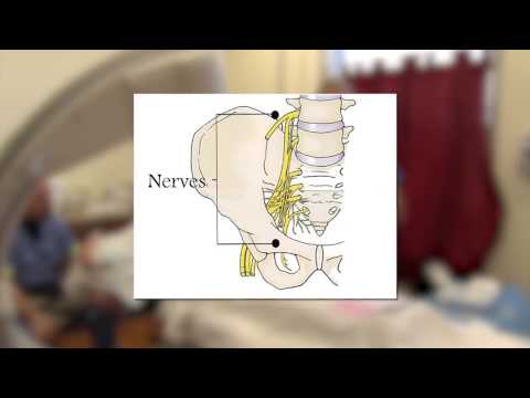 Subacromial steroid injection video