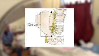 Sacroiliac Joint Injection