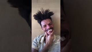 World Biggest Teeth Omg