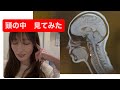 頭の中　見てみた〜MRI撮影後全解説〜