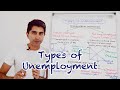 Y1 21 types and causes of unemployment cyclical structural frictional and more