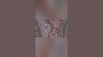 Why Gas Causes Bloating