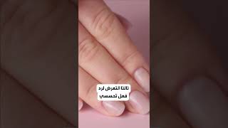 أسباب ظهور البقع البيضاء على الأظافر.. منها حالة خطيرة