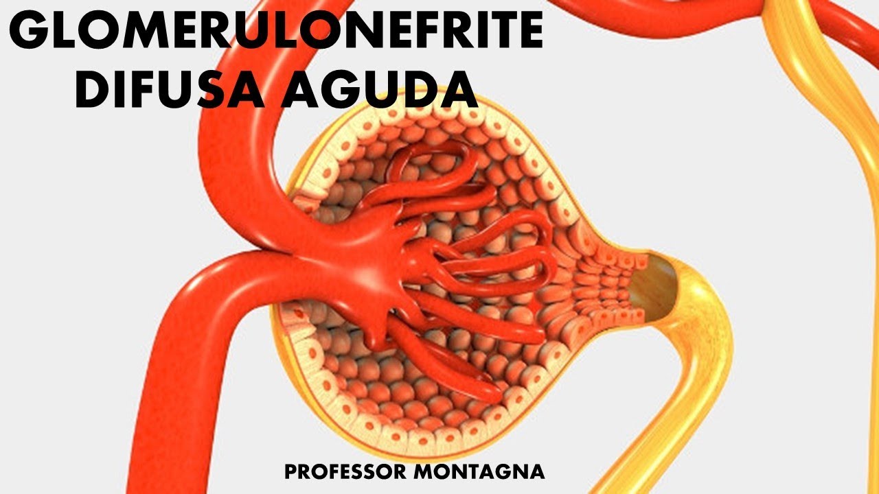 Sinais De Tireoidopatia Difusa O Que Significa - BRAINCP