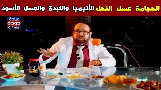 اسألنى شكرا الحجامة عسل النحل الأنيميا والكبدة والعسل الأسود