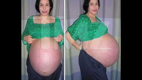 Octo Mom-- Part 1 (On-Air Idiot Show)