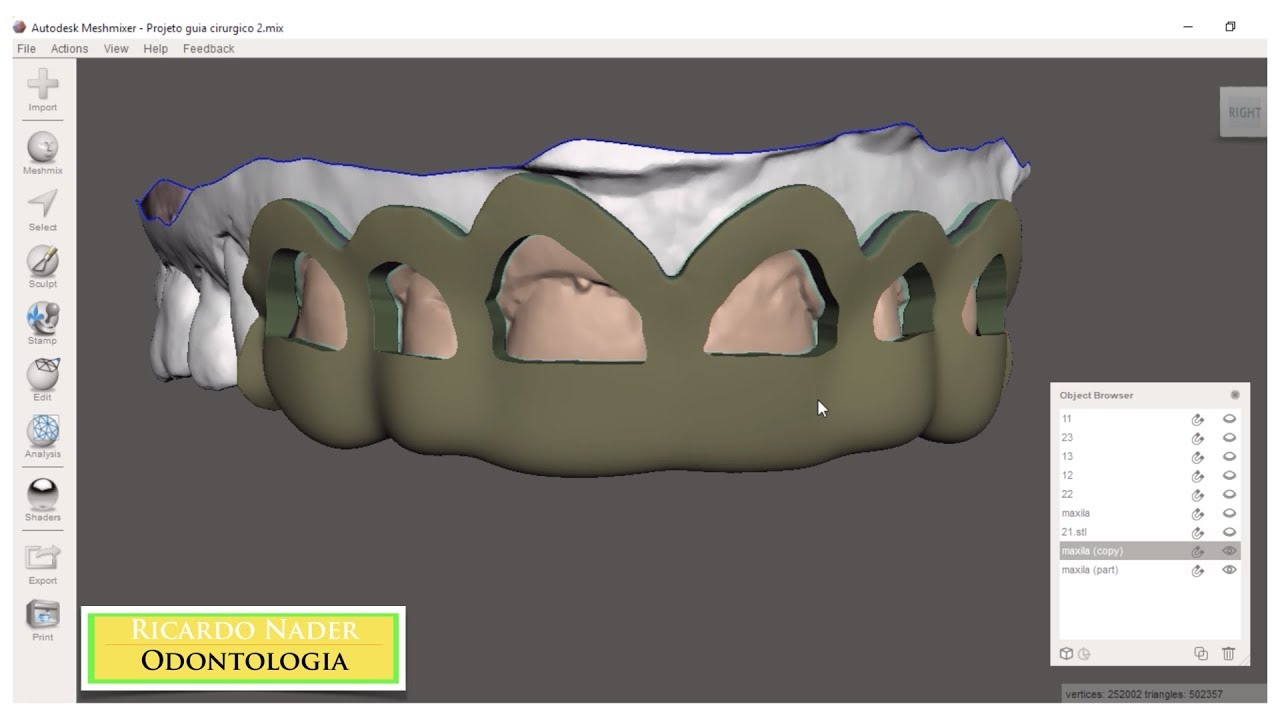 Confecção de guia periodontal no meshmixer