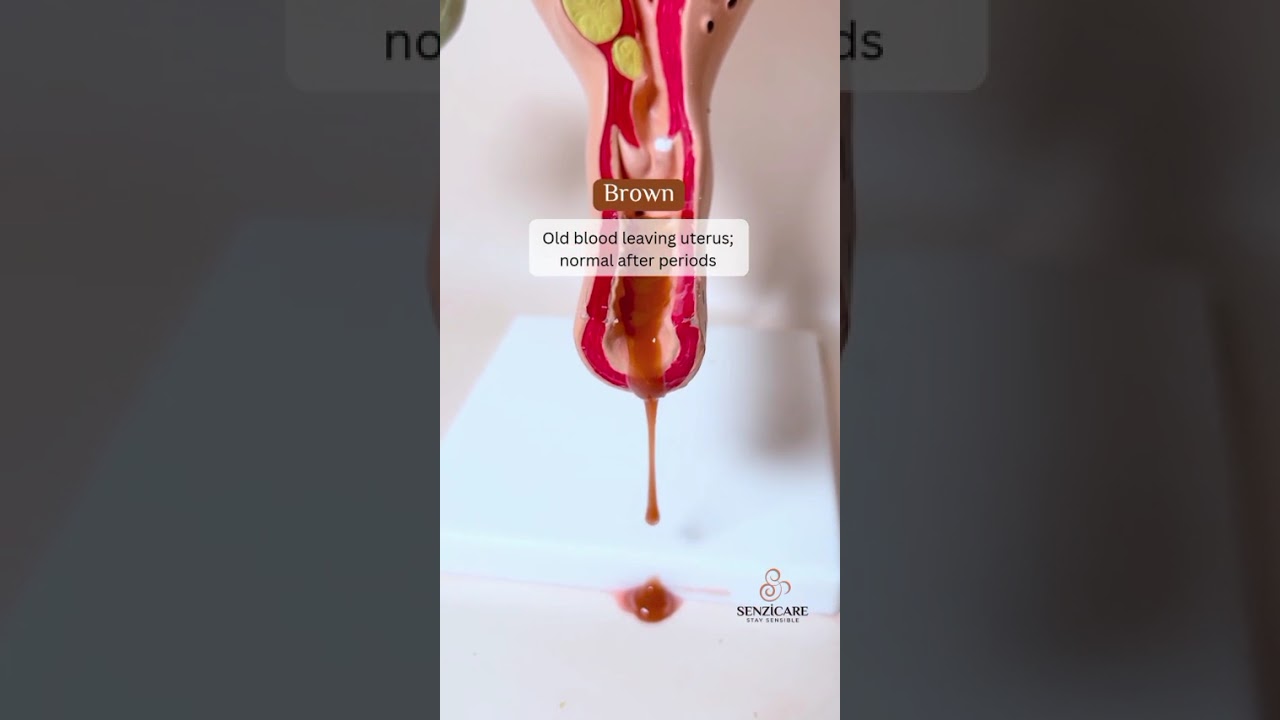 Vaginal discharge is your body’s natural way of cleaning and protecting the vagina.