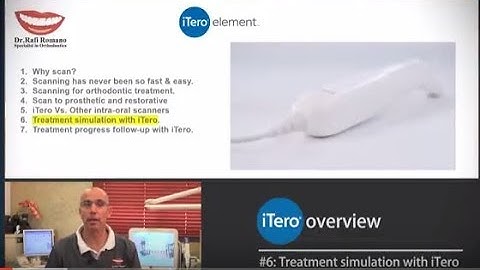 Dr. Rafi Romano, iTero Overview- part 6: Treatment simulation