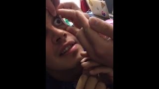 MILO TRIES CONTACT LENSES FOR THE FIRST TIME