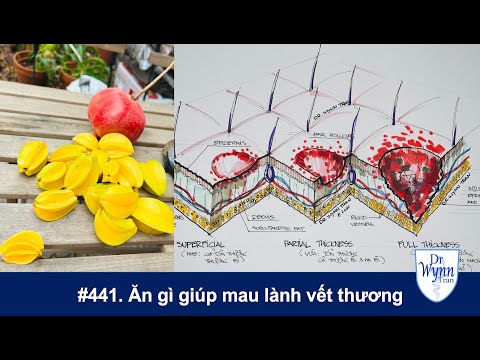 Video: 3 cách để chữa lành vết loét nhanh chóng