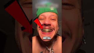 The Man With a Metal Smile 😳