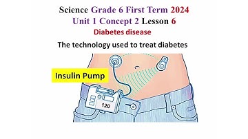Science Grade 6 First Term 2024 Unit 1 Concept 2 Lesson 6 Diabetes disease