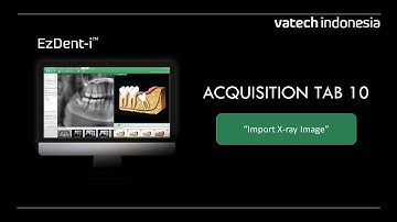 EzDent-i: "Acquisition Tab 10: Import Xray Image"