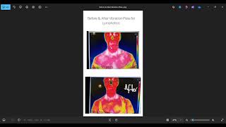 Thermography Before & After Vibration Plate Test