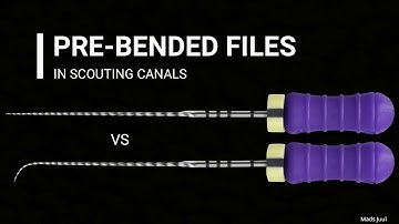 Why pre-bend files when scouting canals?