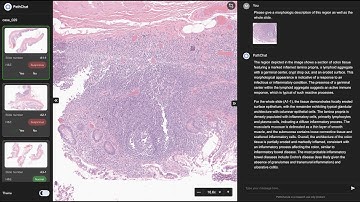 Introducing PathChat™ 2a, a Generative and Agentic AI Copilot for Pathology