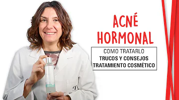 ¿Qué hormona causa el acné en la barbilla?