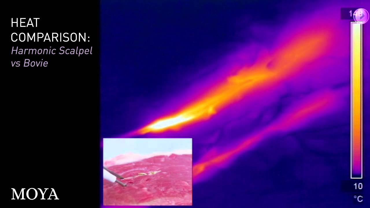 Harmonic Scalpel vs Bovie YouTube