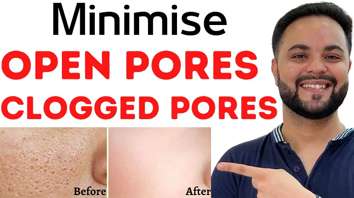 Open Pores,Clogged Pores & Enlarged Pores Solution with Home Remedies - DayDayNews